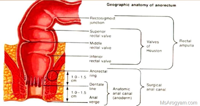 Bleeding and Pain in rectum hemorrhoids